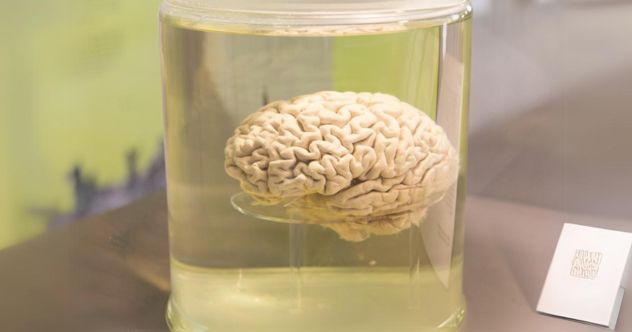 10 Scientists Who Enabled Brains to Survive Bodily Death